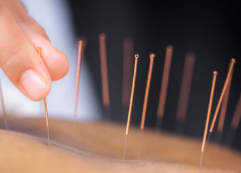 acupuncture-weight-loss acupuncture-weight-loss