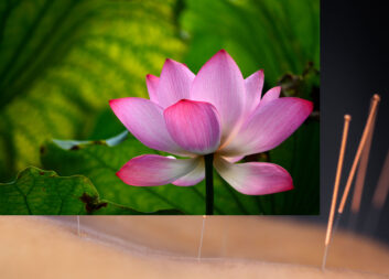 lotus lotus
